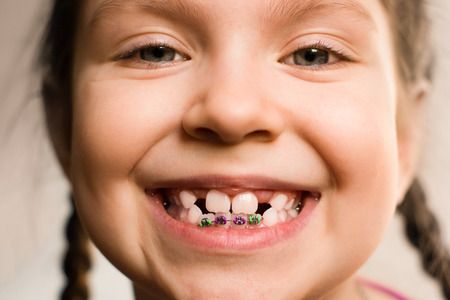 Inschrijfformulier Orthodontie van Gemert